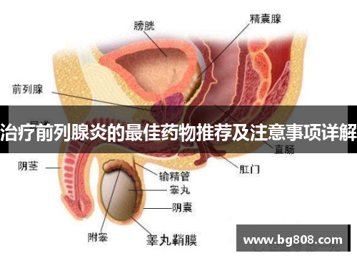 治疗前列腺炎的最佳药物推荐及注意事项详解